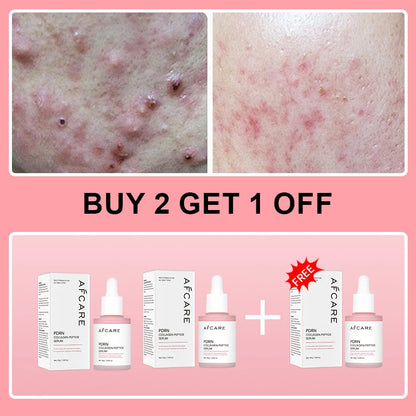 Collagen Peptide Facial Serum