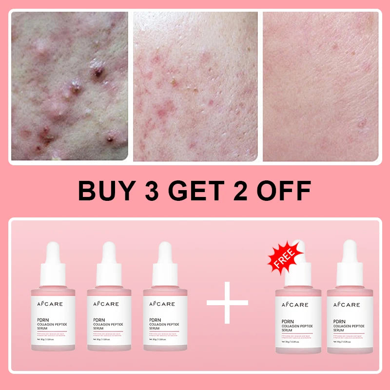 Collagen Peptide Facial Serum